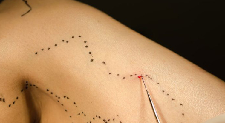 Cirurgião Vascular e Angiologista em Fortaleza,