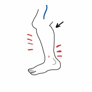Dor na perna: o que pode ser?